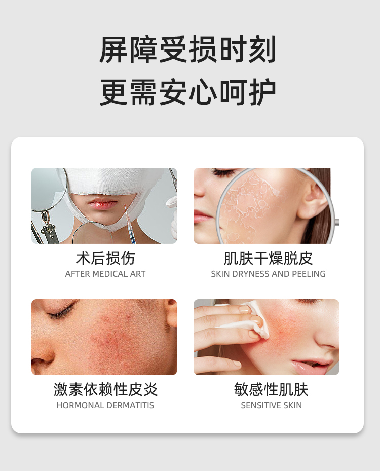 【医圣安敏感肌防护组合4套】修护水4盒+修护乳4盒+修护霜4盒+修护面膜20盒